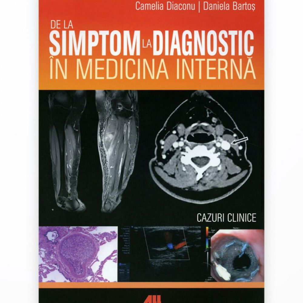 De la simptom la diagnostic in medicina interna - Camelia Diaconu, Daniela Bartos